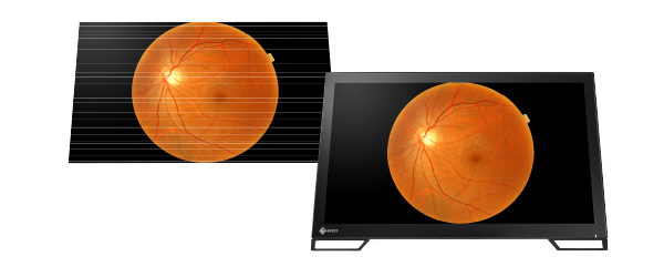 EIZO RadiForce MS236WT